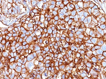 CD44 Antibody