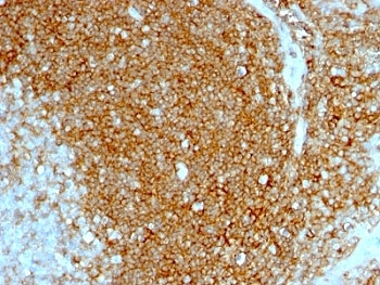 HCAM Antibody