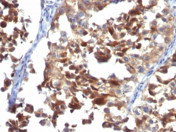 CD63 Antibody / LAMP-3
