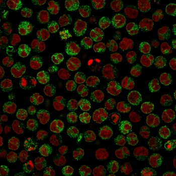 CD79a Antibody
