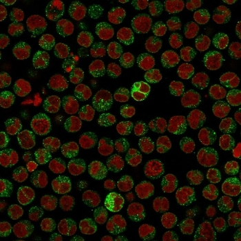 CD79a Antibody