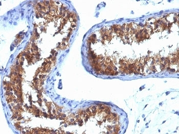 Major Vault Protein Antibody