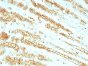 Pan Cytokeratin Antibody