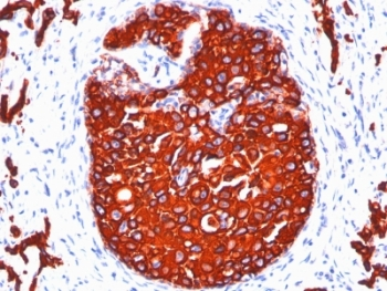 Pan Cytokeratin Antibody