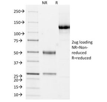 Cytokeratin 10/13 Antibody