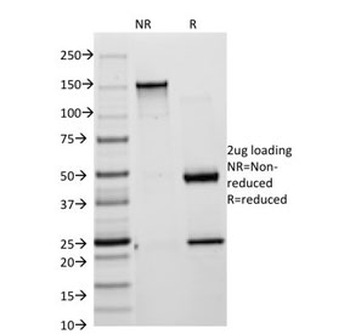 Cytokeratin 8/18 Antibody Cocktail