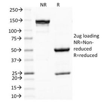 Melanoma Antibody / PNL2