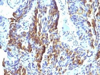 Melanoma Associated Antigen KBA.62 Antibody