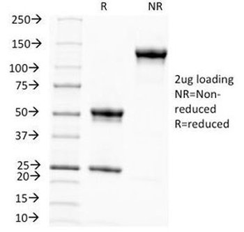 Melanoma Associated Antigen KBA.62 Antibody