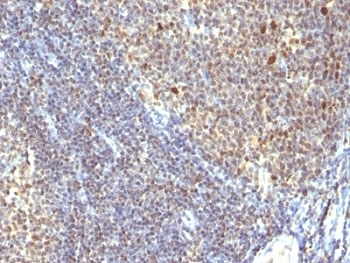 IPO38 Antibody (Proliferation Marker)
