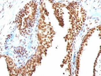 dsDNA Antibody