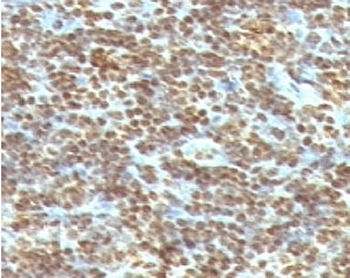 dsDNA Antibody