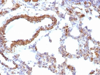 Pan Muscle Actin Antibody