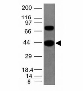 Pan Muscle Actin Antibody