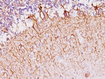 Neurofilament Antibody