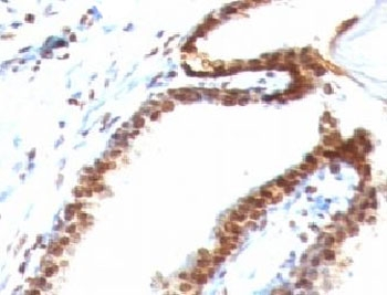 Double Stranded DNA Antibody