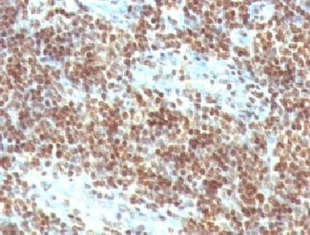 Double Stranded DNA Antibody