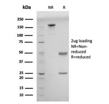 Double Stranded DNA Antibody