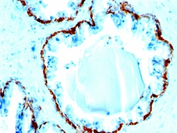 Basic Cytokeratin Antibody
