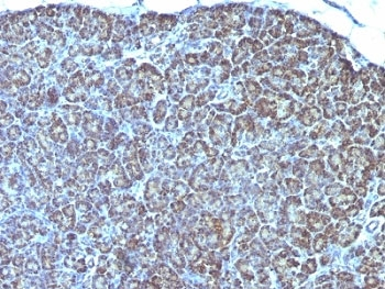 Mitochondrial Antibody