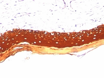 Acidic Cytokeratin Antibody