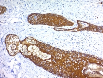 Basic Cytokeratin Antibody