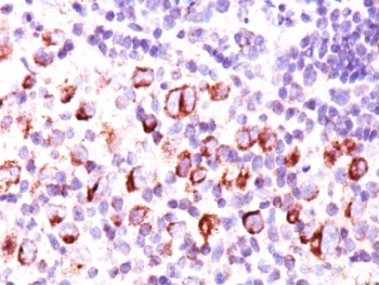 Bcl-X Antibody Cocktail