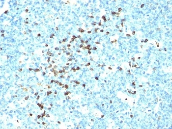IgM Antibody