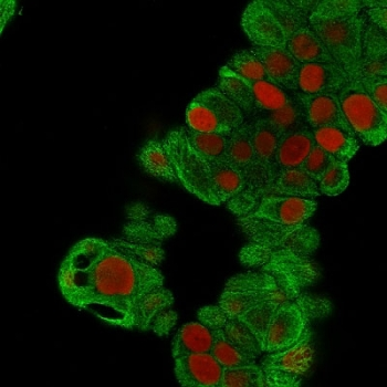 Keratin 19 Antibody