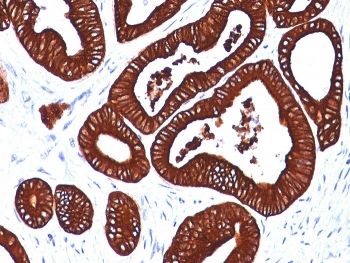 Keratin 19 Antibody