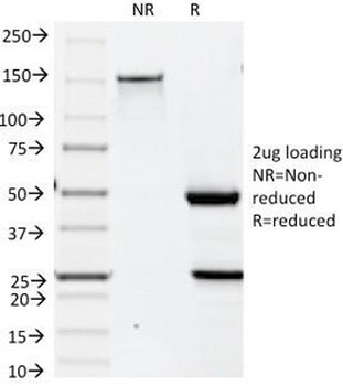 Keratin 19 Antibody