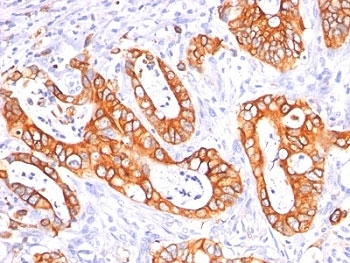 MUC1 Antibody Cocktail