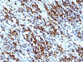 Myogenin Antibody Cocktail