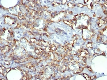 CD31 Antibody / PECAM1