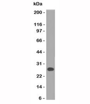 Lambda Light Chain Antibody