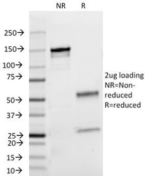 Lambda Light Chain Antibody