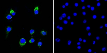 Lambda Light Chain Antibody