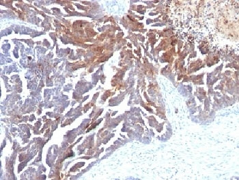 TAG-72 Antibody