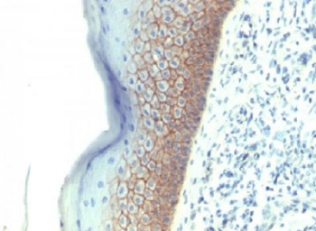E-Cadherin Antibody / CDH1