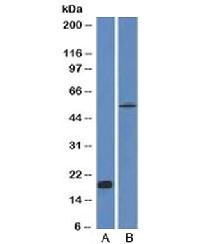 E-Cadherin Antibody / CDH1