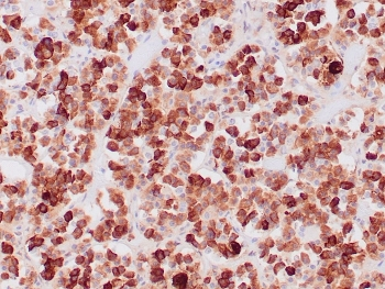 ACTH Antibody / CLIP