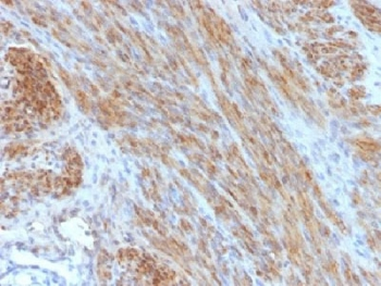 Desmin Antibody