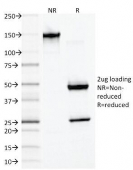 Desmin Antibody
