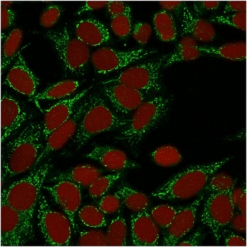 Galectin 1 Antibody / LGALS1