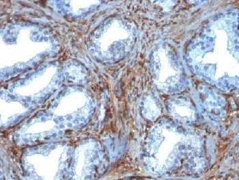 Galectin 1 Antibody / LGALS1