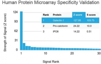 Galectin 1 Antibody / LGALS1