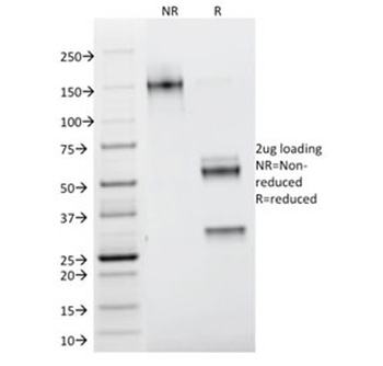 Galectin 1 Antibody / LGALS1
