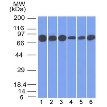 Gamma Catenin Antibody / Plakoglobin
