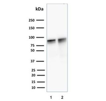 Gamma Catenin Antibody / Plakoglobin