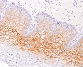 Gamma Catenin Antibody / Plakoglobin